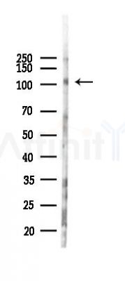Phospho-EPHA7 (Tyr614) Antibody - Western blot analysis of lysates from HUVEC cells(starvation,24h treatment), using Phospho-EPHA7 (Tyr614) Antibody at 1/1000 dilution.