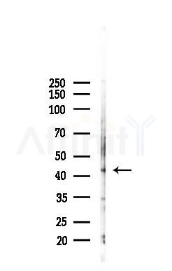 Phospho-Atg14 (Thr429) Antibody - Western blot analysis of lysates from HepG2 cells(heat-shock,45min treatment), using Phospho-Atg14 (Thr429) Antibody at 1/1000 dilution.