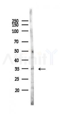 Phospho-TMEM173/STING (Ser366) Antibody - Western blot analysis of lysates from 293 cells(UV,30min treatment), using Phospho-TMEM173/STING (Ser366) Antibody at 1/1000 dilution.