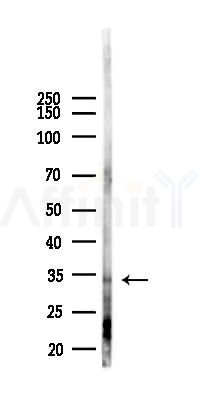 Phospho-TMEM173/STING (Ser366) Antibody - Western blot analysis of lysates from HUVEC cells(starvation,24h treatment), using Phospho-TMEM173/STING (Ser366) Antibody at 1/1000 dilution.