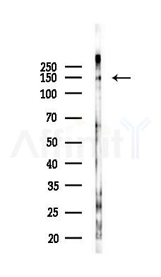 Phospho-PERK (Ser555) Antibody - Western blot analysis of lysates from B16F10-LUC cells(uv30min treatment), using Phospho-PERK (Ser555) Antibody at 1/1000 dilution.