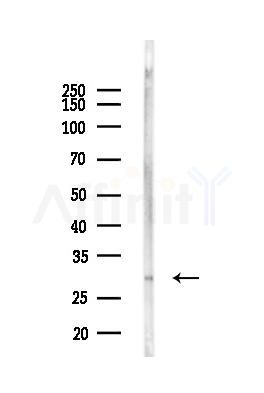 CDK20 Antibody - Western blot analysis of lysates from Mouse liver, using CDK20 Antibody at 1/1000 dilution.