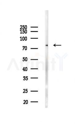SKI Antibody - Western blot analysis of lysates from Mouse liver, using SKI Antibody at 1/1000 dilution.
