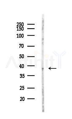 CTGF Antibody - Western blot analysis of lysates from LoVo cells(heat-shock,45min treatment), using CTGF Antibody at 1/1000 dilution.