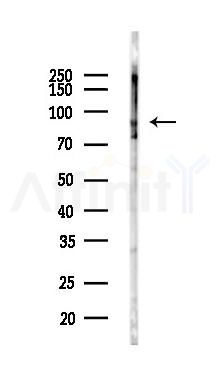 KCNH2 Antibody - Western blot analysis of lysates from COLO205 cells(LPS,4h treatment), using KCNH2 Antibody at 1/1000 dilution.