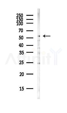 SLC16A1 Antibody - Western blot analysis of lysates from PC12 cells(LPS,4h treatment), using SLC16A1 Antibody at 1/1000 dilution.