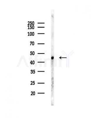 EIF4A1 Antibody - Western blot analysis of lysates from LoVo cells(heat-shock,45min treatment), using EIF4A1 Antibody at 1/1000 dilution.
