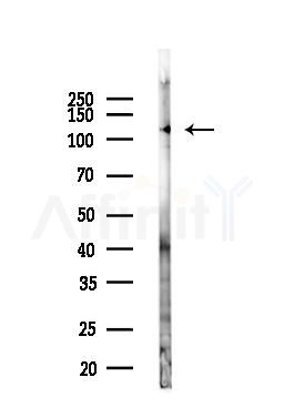 BCL11A Antibody - Western blot analysis of lysates from Mouse liver, using BCL11A Antibody at 1/1000 dilution.