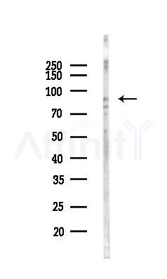 CDC5L Antibody - Western blot analysis of lysates from COLO205 cells(LPS,4h treatment), using CDC5L Antibody at 1/1000 dilution.
