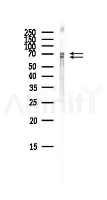 USP22 Antibody - Western blot analysis of lysates from Mouse brain, using USP22 Antibody at 1/1000 dilution.