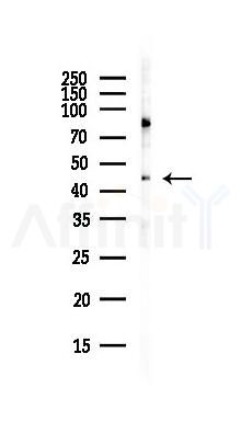 Caspase 2 Antibody - Western blot analysis of lysates from COLO205 cells(heat-shock,45min treatment), using Caspase 2 Antibody at 1/1000 dilution.