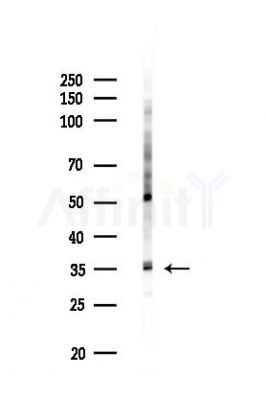osterix Antibody - Western blot analysis of lysates from HUVEC cells(LPS,4h treatment), using osterix Antibody at 1/1000 dilution.