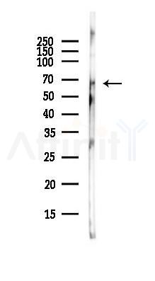 PINK1 Antibody - Western blot analysis of lysates from COLO205 cells(heat-shock,45min treatment), using PINK1 Antibody at 1/1000 dilution.