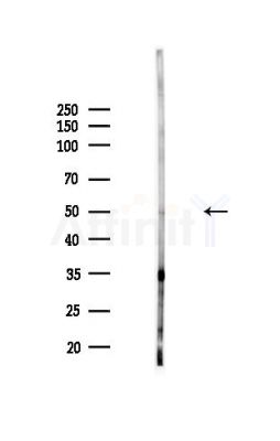 TFAP2C Antibody - Western blot analysis of lysates from MDA-MB-231 cells(heat-shock,45min treatment), using TFAP2C Antibody at 1/1000 dilution.