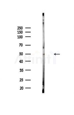 TFAP2C Antibody - Western blot analysis of lysates from Hela cells(heat-shock,45min treatment), using TFAP2C Antibody at 1/1000 dilution.