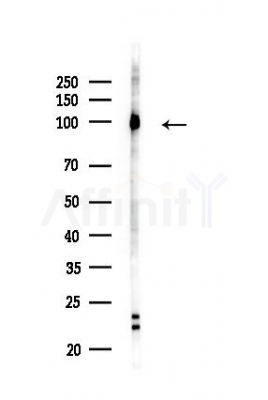 CUL4B Antibody - Western blot analysis of lysates from HUVEC cells(LPS,4h treatment), using CUL4B Antibody at 1/1000 dilution.