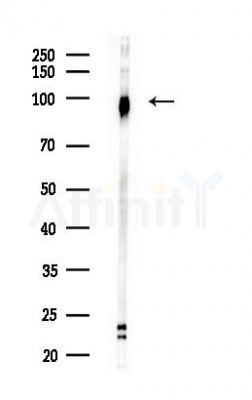 CUL4B Antibody - Western blot analysis of lysates from COLO205 cells(heat-shock,45min treatment), using CUL4B Antibody at 1/1000 dilution.