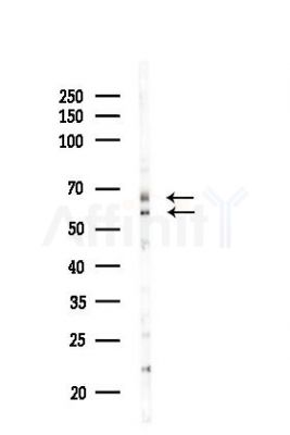 PAX7 Antibody - Western blot analysis of lysates from HUVEC cells(LPS,4h treatment), using PAX7 Antibody at 1/1000 dilution.