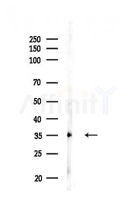 Annexin A2 Antibody - Western blot analysis of lysates from HUVEC cells(LPS,4h treatment), using Annexin A2 Antibody at 1/1000 dilution.