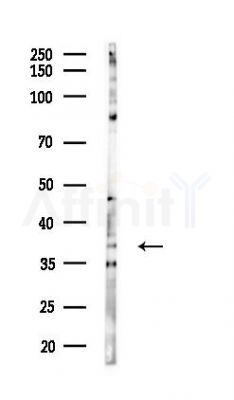 Annexin A2 Antibody - Western blot analysis of lysates from COLO205 cells(heat-shock,45min treatment), using Annexin A2 Antibody at 1/1000 dilution.
