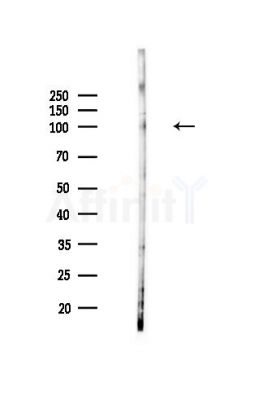 Semaphorin 4B Antibody - Western blot analysis of lysates from Hela cells(heat-shock,45min treatment), using Semaphorin 4B Antibody at 1/1000 dilution.