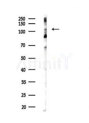 MYPT1 Antibody - Western blot analysis of lysates from COLO205 cells(heat-shock,45min treatment), using MYPT1 Antibody at 1/1000 dilution.