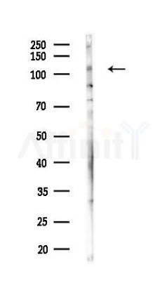 MYPT1 Antibody - Western blot analysis of lysates from COLO205 cells(heat-shock,45min treatment), using MYPT1 Antibody at 1/1000 dilution.