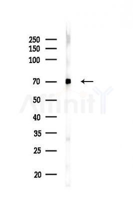 MDM4 Antibody - Western blot analysis of lysates from HUVEC cells(LPS,4h treatment), using MDM4 Antibody at 1/1000 dilution.