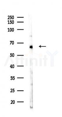 MDM4 Antibody - Western blot analysis of lysates from COLO205 cells(heat-shock,45min treatment), using MDM4 Antibody at 1/1000 dilution.