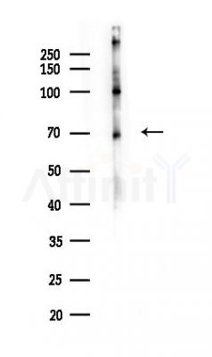 PDPK1 Antibody - Western blot analysis of lysates from COLO205 cells(heat-shock,45min treatment), using PDPK1 Antibody at 1/1000 dilution.