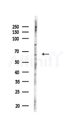 TAK1 Antibody - Western blot analysis of lysates from HUVEC cells(LPS,4h treatment), using TAK1 Antibody at 1/1000 dilution.
