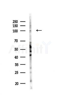 FOXO3A Antibody - Western blot analysis of lysates from HUVEC cells(LPS,4h treatment), using FOXO3A Antibody at 1/1000 dilution.