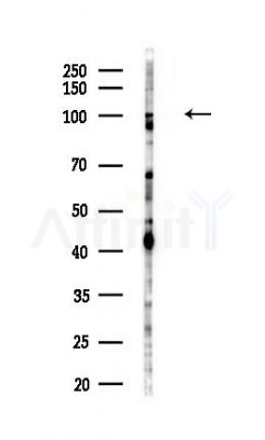 FOXO3A Antibody - Western blot analysis of lysates from COLO205 cells(heat-shock,45min treatment), using FOXO3A Antibody at 1/1000 dilution.