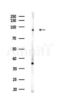 FOXO3A Antibody - Western blot analysis of lysates from COLO205 cells(heat-shock,45min treatment), using FOXO3A Antibody at 1/1000 dilution.