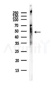 Doublecortin Antibody - Western blot analysis of lysates from COLO205 cells(heat-shock,45min treatment), using Doublecortin Antibody at 1/1000 dilution.