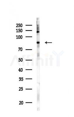 p95/NBS1 Antibody - Western blot analysis of lysates from HUVEC cells(LPS,4h treatment), using p95/NBS1 Antibody at 1/1000 dilution.