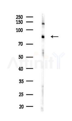 p95/NBS1 Antibody - Western blot analysis of lysates from COLO205 cells(heat-shock,45min treatment), using p95/NBS1 Antibody at 1/1000 dilution.