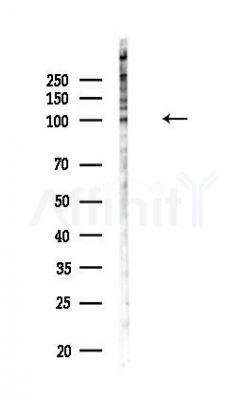 IRE1 Antibody - Western blot analysis of lysates from HUVEC cells(LPS,4h treatment), using IRE1 Antibody at 1/1000 dilution.