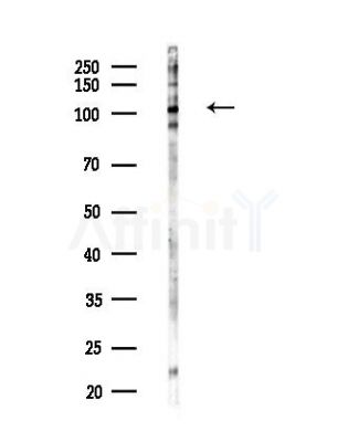IRE1 Antibody - Western blot analysis of lysates from COLO205 cells(heat-shock,45min treatment), using IRE1 Antibody at 1/1000 dilution.