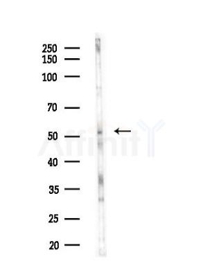 STAM2 Antibody - Western blot analysis of lysates from COLO205 cells(heat-shock,45min treatment), using STAM2 Antibody at 1/1000 dilution.