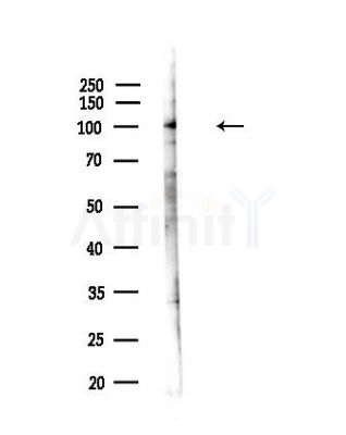 KIF20A Antibody - Western blot analysis of lysates from COLO205 cells(heat-shock,45min treatment), using KIF20A Antibody at 1/1000 dilution.