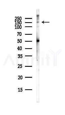 LATS1 Antibody - Western blot analysis of lysates from COLO205 cells(heat-shock,45min treatment), using LATS1 Antibody at 1/1000 dilution.