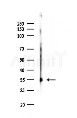 LDHA Antibody - Western blot analysis of lysates from HUVEC cells(LPS,4h treatment), using LDHA Antibody at 1/1000 dilution.