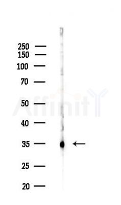 LDHA Antibody - Western blot analysis of lysates from COLO205 cells(heat-shock,45min treatment), using LDHA Antibody at 1/1000 dilution.