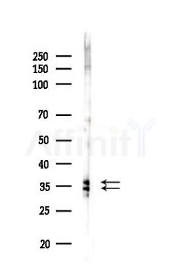 LDHA Antibody - Western blot analysis of lysates from HUVEC cells(LPS,4h treatment), using LDHA Antibody at 1/1000 dilution.