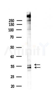 LDHA Antibody - Western blot analysis of lysates from COLO205 cells(heat-shock,45min treatment), using LDHA Antibody at 1/1000 dilution.