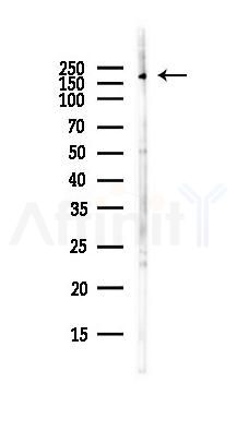 HER2/ErbB2 Antibody - Western blot analysis of lysates from COLO205 cells(heat-shock,45min treatment), using HER2/ErbB2 Antibody at 1/1000 dilution.