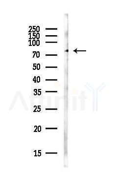 PKC beta 1 Antibody - Western blot analysis of lysates from PC12 cells(LPS,4h treatment), using PKC beta 1 Antibody at 1/1000 dilution.