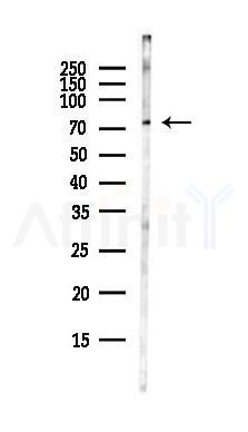 PKC beta 1 Antibody - Western blot analysis of lysates from COLO205 cells(heat-shock,45min treatment), using PKC beta 1 Antibody at 1/1000 dilution.