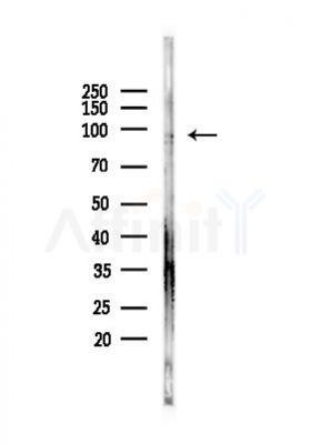 IGF1 Receptor Antibody - Western blot analysis of lysates from A375 cells(heat-shock, 45min treatment), using IGF1 Receptor Antibody at 1/1000 dilution.